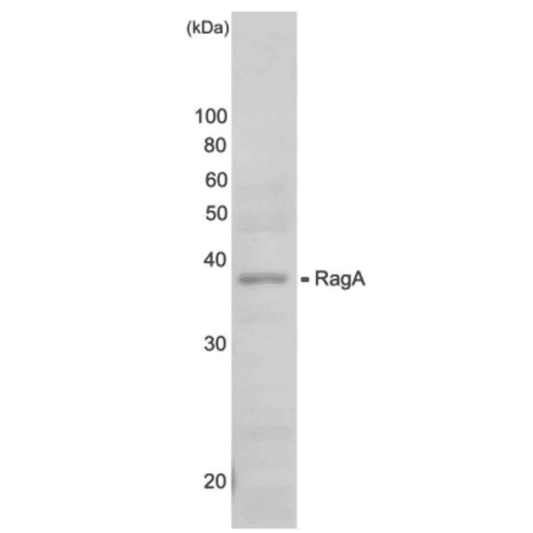 Western blot analysis of RagA protein in the whole cell extracts (HeLa cell g). Anti-RagA antiserum was used at 1,000 dilution.