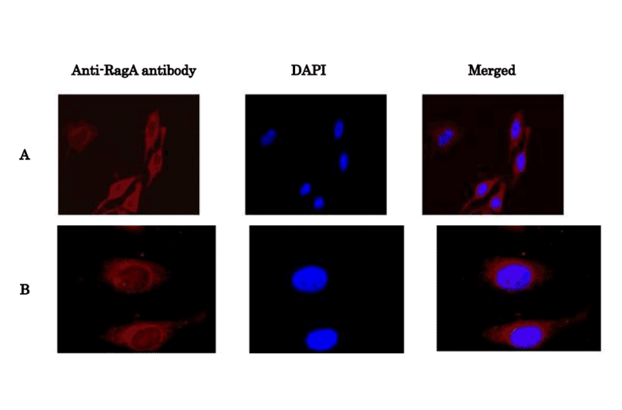 Immunofluorescence staining of RagA protein in HeLa cells with anti-Rag antibody. HeLa cells were fixed with 4% paraformaldehyde and permeabilized with 0.5% TritonX 100 and reacted with anti-RagA antibody at 1/100 dilution (A) or at 1/1,000 dilution (B). As the 2nd antibody, anti-rabbit IgG antibody conjugated with Alexa Fluor 647 was used at 1/1,000 dilution. DNA was stained with DAPI and the merged image was shown on right