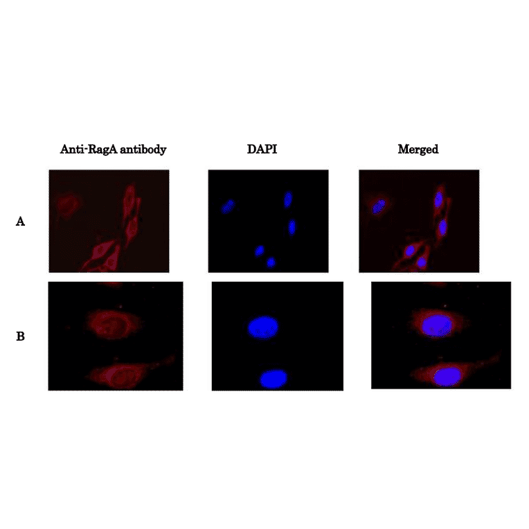 Immunofluorescence staining of RagA protein in HeLa cells with anti-Rag antibody. HeLa cells were fixed with 4% paraformaldehyde and permeabilized with 0.5% TritonX 100 and reacted with anti-RagA antibody at 1/100 dilution (A) or at 1/1,000 dilution (B). As the 2nd antibody, anti-rabbit IgG antibody conjugated with Alexa Fluor 647 was used at 1/1,000 dilution. DNA was stained with DAPI and the merged image was shown on right