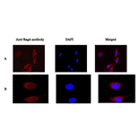 Immunofluorescence staining of RagA protein in HeLa cells with anti-Rag antibody. HeLa cells were fixed with 4% paraformaldehyde and permeabilized with 0.5% TritonX 100 and reacted with anti-RagA antibody at 1/100 dilution (A) or at 1/1,000 dilution (B). As the 2nd antibody, anti-rabbit IgG antibody conjugated with Alexa Fluor 647 was used at 1/1,000 dilution. DNA was stained with DAPI and the merged image was shown on right