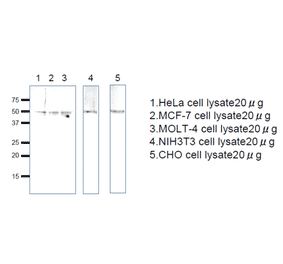 Western blot analysis of Rag C protein in the cell lysates. Anti-RagC antiserum was used at 1/1,000 dilution. Second antibody, anti-rabbit IgG conjugated with HRP, was used at 1/10,000 dilution.