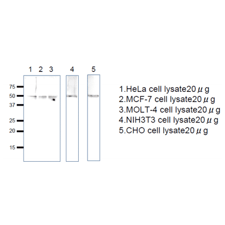 Western blot analysis of Rag C protein in the cell lysates. Anti-RagC antiserum was used at 1/1,000 dilution. Second antibody, anti-rabbit IgG conjugated with HRP, was used at 1/10,000 dilution.