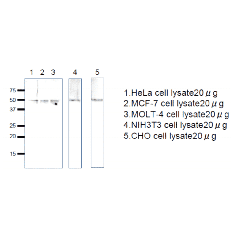 Western blot analysis of Rag C protein in the cell lysates. Anti-RagC antiserum was used at 1/1,000 dilution. Second antibody, anti-rabbit IgG conjugated with HRP, was used at 1/10,000 dilution.