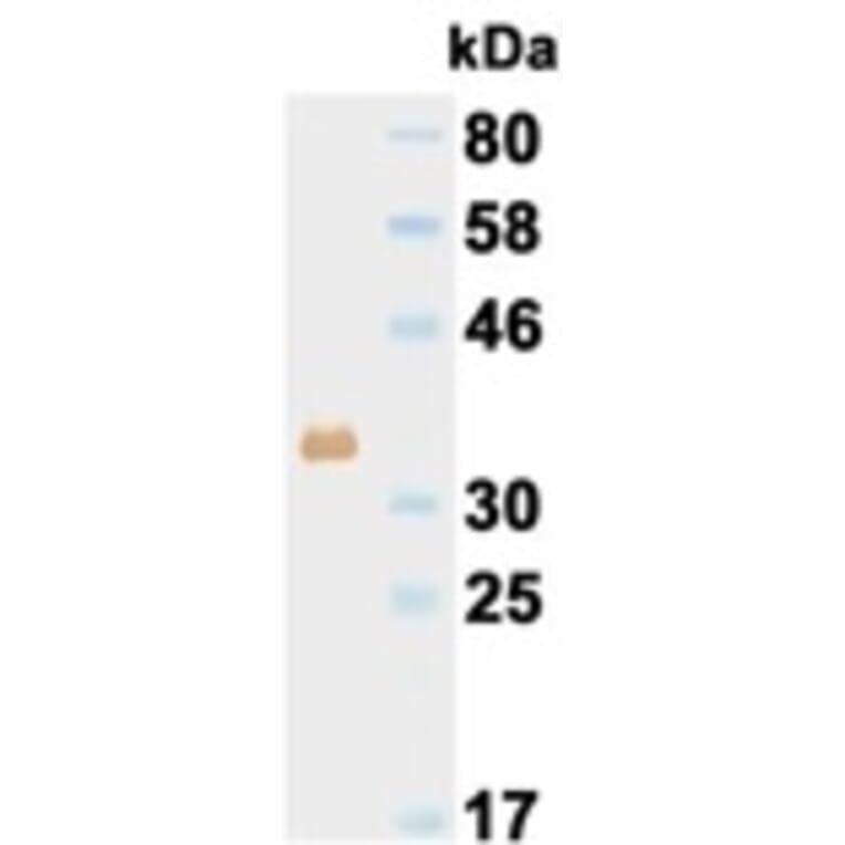 Western Blot - Anti-His Tag Antibody (000015D09) - Antibodies.com