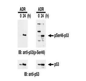 Identification of Ser46-phosphorylated p53 protein by western blotting. Samples: Crude cell extracts of MOLT-4 untreated (left lanes) and treated with adriamycin for 24 h (right lanes). The left panel is the result with our product and the right panel is the one obtained with the product of our competitor. The lower panel is the whole p53 protein identified by omnipotent anti-p53 antibody.