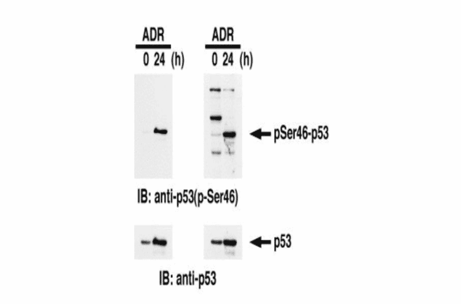 Identification of Ser46-phosphorylated p53 protein by western blotting. Samples: Crude cell extracts of MOLT-4 untreated (left lanes) and treated with adriamycin for 24 h (right lanes). The left panel is the result with our product and the right panel is the one obtained with the product of our competitor. The lower panel is the whole p53 protein identified by omnipotent anti-p53 antibody.