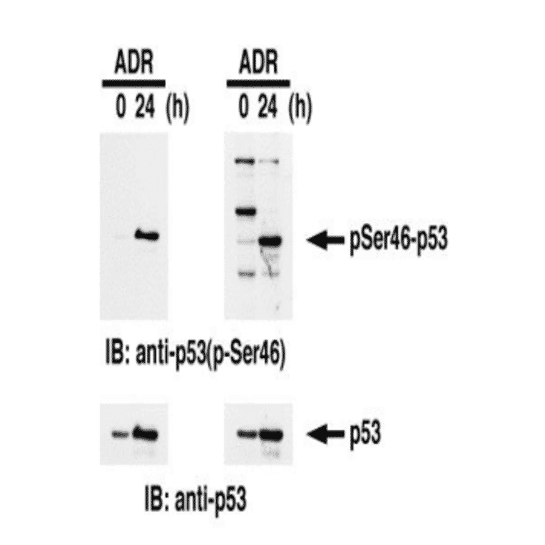 Identification of Ser46-phosphorylated p53 protein by western blotting. Samples: Crude cell extracts of MOLT-4 untreated (left lanes) and treated with adriamycin for 24 h (right lanes). The left panel is the result with our product and the right panel is the one obtained with the product of our competitor. The lower panel is the whole p53 protein identified by omnipotent anti-p53 antibody.