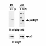 Identification of Ser46-phosphorylated p53 protein by western blotting. Samples: Crude cell extracts of MOLT-4 untreated (left lanes) and treated with adriamycin for 24 h (right lanes). The left panel is the result with our product and the right panel is the one obtained with the product of our competitor. The lower panel is the whole p53 protein identified by omnipotent anti-p53 antibody.