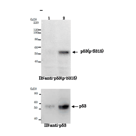 Identification of Ser315-phosphorylated p53 proteinby Western blotting. Sample: Crude cell extracts of MCF7 untreated (lane 1) and treated with nocodazole at 100 ng/ml for 48 h (lane2). The lower panel is the whole p53 protein identified by omnipotent anti-p53 antibody (DO-1).