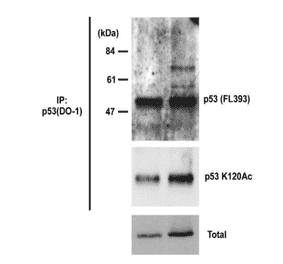 Identification of p53 protein, whose Lys 120 is acetylated, by Western blotting with 10E5 monoclonal antibody. Samples are crude lysates of HCT116 cells: Left lanes are control. Right lanes are cells treated with siRNA to knockdown the expression of a Tip60 interacting protein UHRF1, which results in increase in acetylation of p53 at Lys120. Total p53 was immuno-precipitated with omnipotent anti-p53 monoclonal antibody (DO-1) from the crude extracts and analyzed by Western blotting with anti-p53 antibody (FL393) (upper panel) or anti-p53 acetyl-K120 monoclonal antibody (10E5) (middle panel). The lower panel shows total p53.