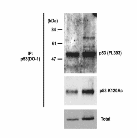 Identification of p53 protein, whose Lys 120 is acetylated, by Western blotting with 10E5 monoclonal antibody. Samples are crude lysates of HCT116 cells: Left lanes are control. Right lanes are cells treated with siRNA to knockdown the expression of a Tip60 interacting protein UHRF1, which results in increase in acetylation of p53 at Lys120. Total p53 was immuno-precipitated with omnipotent anti-p53 monoclonal antibody (DO-1) from the crude extracts and analyzed by Western blotting with anti-p53 antibody (FL393) (upper panel) or anti-p53 acetyl-K120 monoclonal antibody (10E5) (middle panel). The lower panel shows total p53.