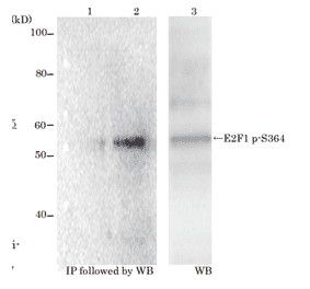 Identification of E2F1 protein phosphorylated at p-Ser364 with monoclonal antibody (#2)