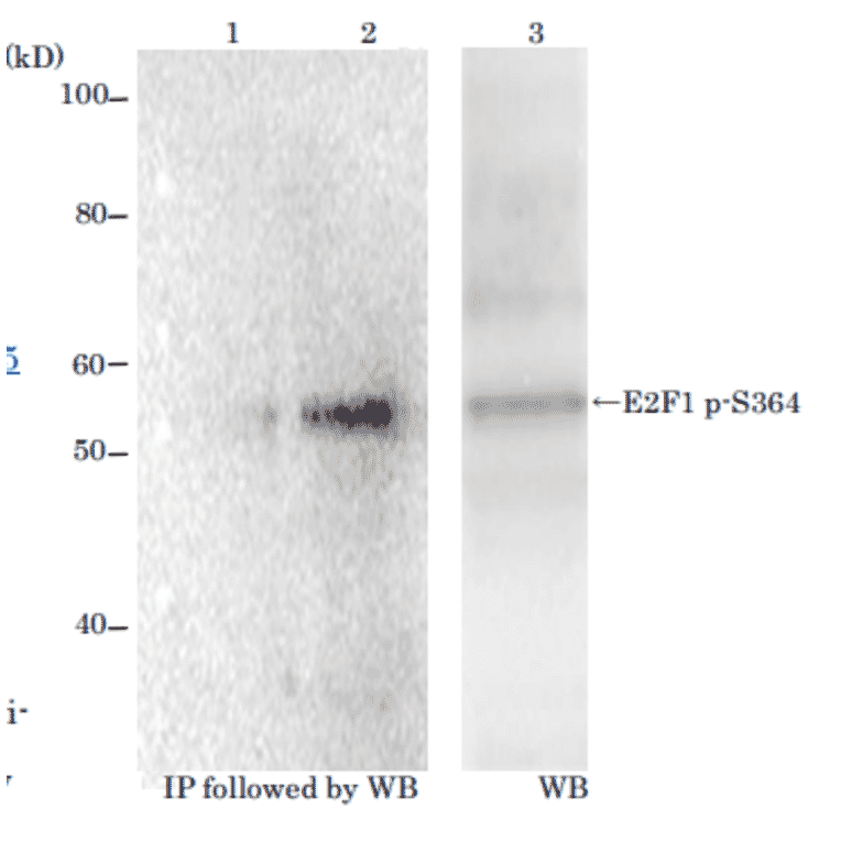 Identification of E2F1 protein phosphorylated at p-Ser364 with monoclonal antibody (#2)