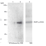 Identification of E2F1 protein phosphorylated at p-Ser364 with monoclonal antibody (#2)