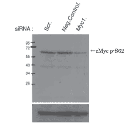 Identification of cMyc protein whose Ser62 is phosphorylated by Western blotting