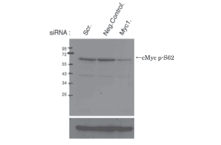 Identification of cMyc protein whose Ser62 is phosphorylated by Western blotting