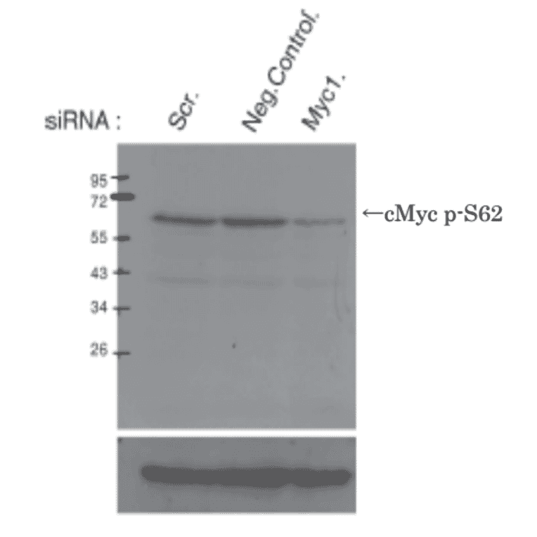Identification of cMyc protein whose Ser62 is phosphorylated by Western blotting