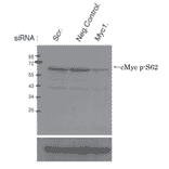 Identification of cMyc protein whose Ser62 is phosphorylated by Western blotting