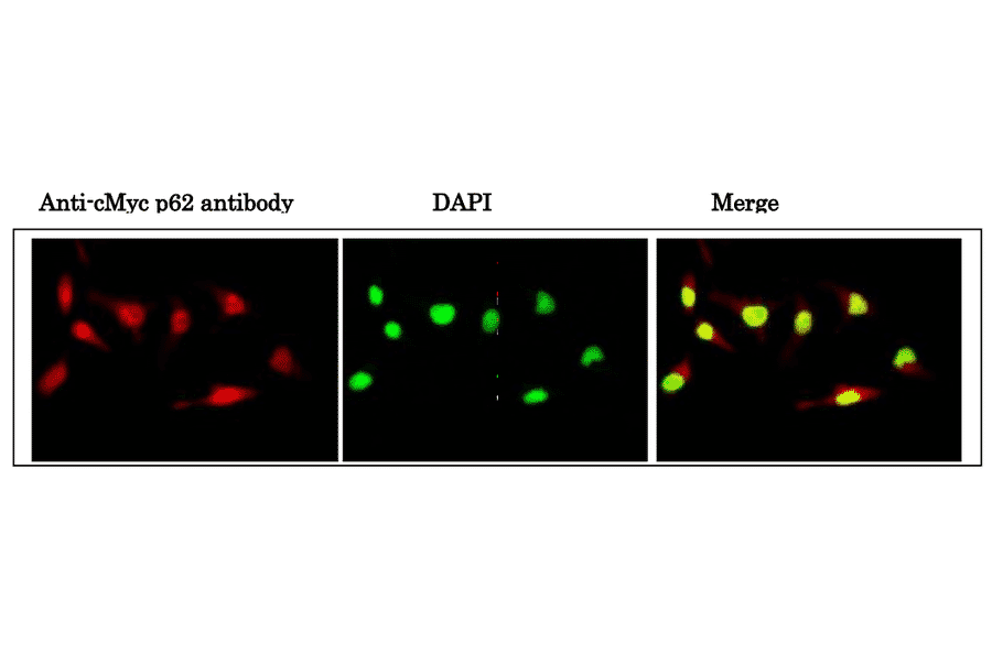 Immunofluorescence staining of cMyc phosho-Ser62 in nuclei of HeLa cells. 1. HeLa cells were fixed with 4% paraformaldehyde overnight, permealized with 0.25% Triton X-100 in PBS for 10 min. 2. Incubate cells with 1.5% BSA in PBS for 30 min to block non-specific binding of the antibodies. Incubate the cells with 1/2,000 diluted anti-cMyc p62 antibody in 1% BSA in PBS at 4? overnight. 3. Incubate cells with a secondary antibody, goat anti-mouse IgG conjugated with Alex 488, at 1/1,000 dilution in 1% BSA for 1 hr at room temperature. 4. Nucleus (DNA) was stained with DAPI