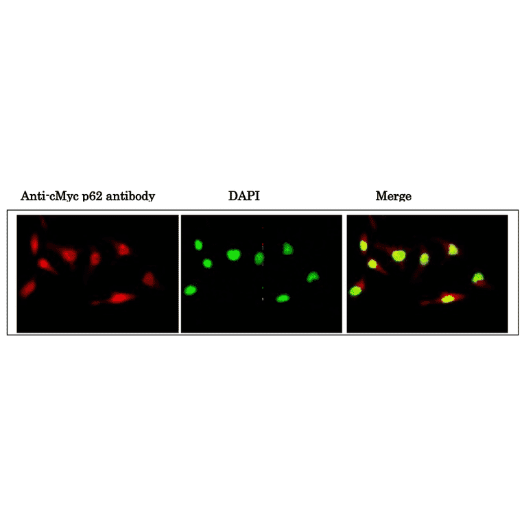 Immunofluorescence staining of cMyc phosho-Ser62 in nuclei of HeLa cells. 1. HeLa cells were fixed with 4% paraformaldehyde overnight, permealized with 0.25% Triton X-100 in PBS for 10 min. 2. Incubate cells with 1.5% BSA in PBS for 30 min to block non-specific binding of the antibodies. Incubate the cells with 1/2,000 diluted anti-cMyc p62 antibody in 1% BSA in PBS at 4? overnight. 3. Incubate cells with a secondary antibody, goat anti-mouse IgG conjugated with Alex 488, at 1/1,000 dilution in 1% BSA for 1 hr at room temperature. 4. Nucleus (DNA) was stained with DAPI