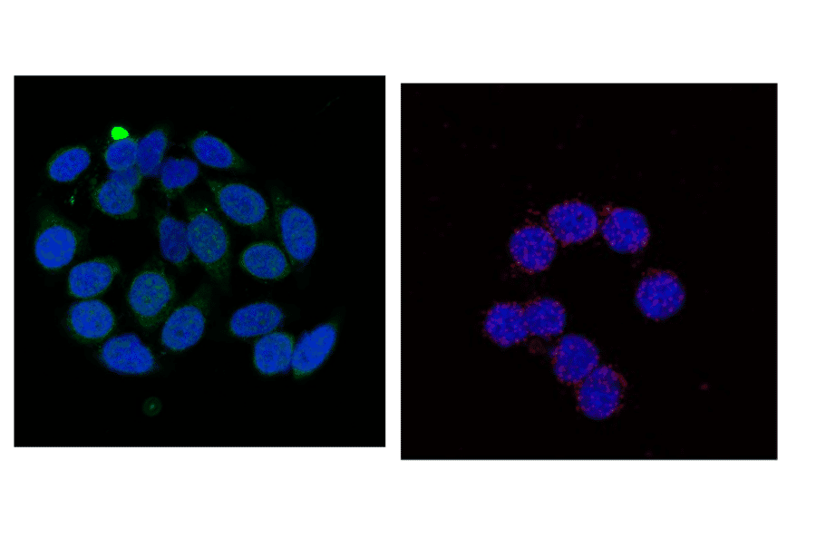 Immunofluorescence staining of cMyc phosho-Ser62 in HeLa cells