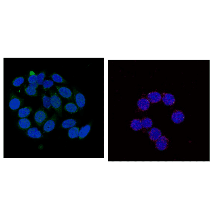 Immunofluorescence staining of cMyc phosho-Ser62 in HeLa cells