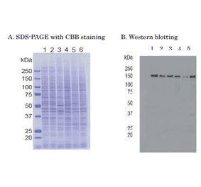 Western blot of of RBP2 in crude cell extracts Samples: 1. HeLa control siRNA 2. HeLa RBP2 siRNA 3. MCF7 4. U2OS 5. NIH3T3 6. J1 (mouse ES)