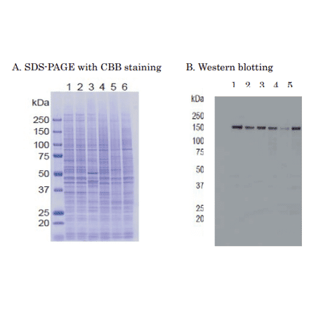 Western blot of of RBP2 in crude cell extracts Samples: 1. HeLa control siRNA 2. HeLa RBP2 siRNA 3. MCF7 4. U2OS 5. NIH3T3 6. J1 (mouse ES)