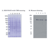 Western blot of of RBP2 in crude cell extracts Samples: 1. HeLa control siRNA 2. HeLa RBP2 siRNA 3. MCF7 4. U2OS 5. NIH3T3 6. J1 (mouse ES)