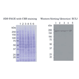 Weastern blot of RBP2 in crude cell extracts Samples: 1. HeLa control siRNA 2. HeLa RBP2 siRNA 3. MCF7 4. U2OS 5. NIH3T3 6. J1 (mouse ES)