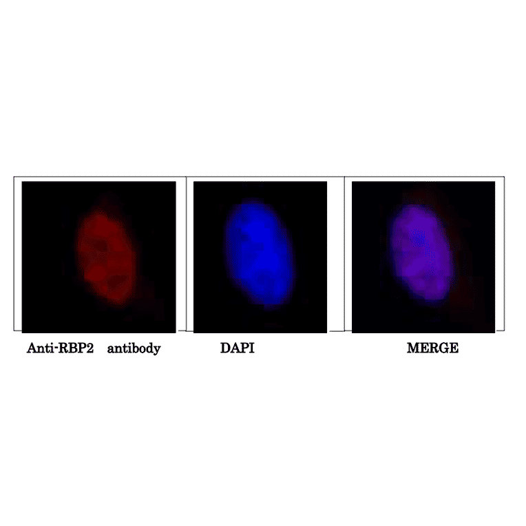 Immunofluorescence staining of HeLa cell with anti-RBP” antibody