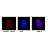 Immunofluorescence staining of HeLa cell with anti-RBP” antibody