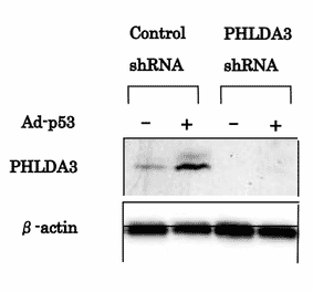 Western blotting was performed using the antibody 4B6 to detect PHLDA3 protein expression. PHLDA3 protein was induced by Ad-p53 in MDA-MB-468 cells (left). PHLDA3 expression was inhibited by shRNA targeting PHLDA3 (right)