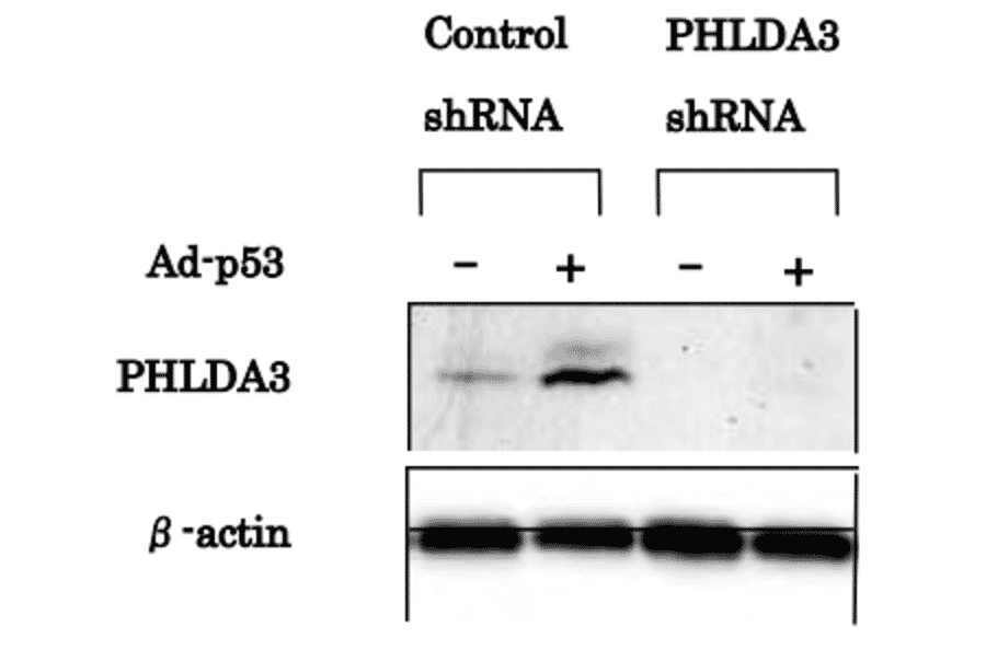 Western blotting was performed using the antibody 4B6 to detect PHLDA3 protein expression. PHLDA3 protein was induced by Ad-p53 in MDA-MB-468 cells (left). PHLDA3 expression was inhibited by shRNA targeting PHLDA3 (right)