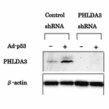 Western blotting was performed using the antibody 4B6 to detect PHLDA3 protein expression. PHLDA3 protein was induced by Ad-p53 in MDA-MB-468 cells (left). PHLDA3 expression was inhibited by shRNA targeting PHLDA3 (right)