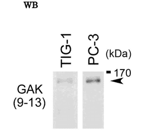 Western blot analysis of endogenous GAK in whole cell extracts of TIG-1 and PC-3 cells with anti-GAK monoclonal antibody, 9-13 The anti-GAK antibody was used at 1/500 dilution. The image is obtained from Prof. H. Nojima at Osaka University