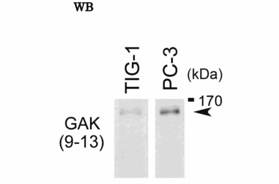 Western blot analysis of endogenous GAK in whole cell extracts of TIG-1 and PC-3 cells with anti-GAK monoclonal antibody, 9-13 The anti-GAK antibody was used at 1/500 dilution. The image is obtained from Prof. H. Nojima at Osaka University