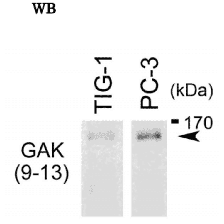 Western blot analysis of endogenous GAK in whole cell extracts of TIG-1 and PC-3 cells with anti-GAK monoclonal antibody, 9-13 The anti-GAK antibody was used at 1/500 dilution. The image is obtained from Prof. H. Nojima at Osaka University