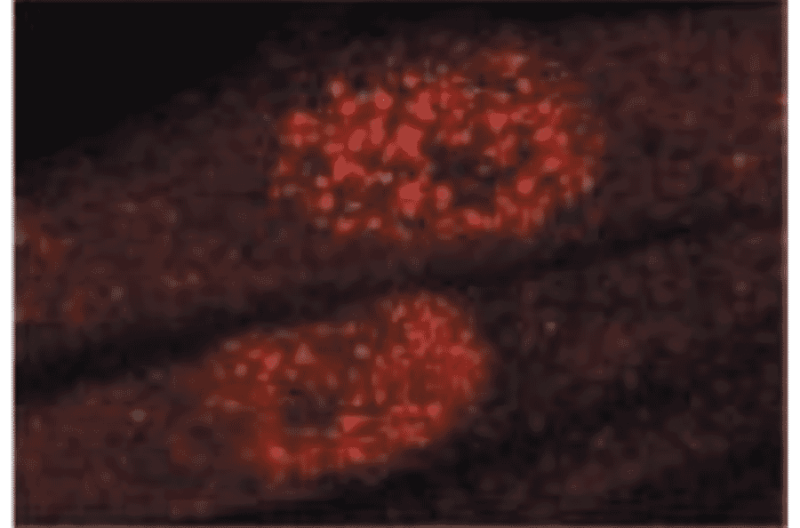 Immunofluorescence staining of GAK in TIG-1 cells with anti-GAK antibody (9-13). The antibody was used at 1/50 dilution. As the second antibody, Texas-Red conjugated sheep anti-mouse IgG was used.