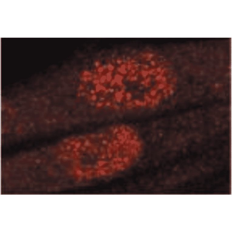 Immunofluorescence staining of GAK in TIG-1 cells with anti-GAK antibody (9-13). The antibody was used at 1/50 dilution. As the second antibody, Texas-Red conjugated sheep anti-mouse IgG was used.