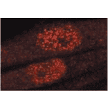 Immunofluorescence staining of GAK in TIG-1 cells with anti-GAK antibody (9-13). The antibody was used at 1/50 dilution. As the second antibody, Texas-Red conjugated sheep anti-mouse IgG was used.