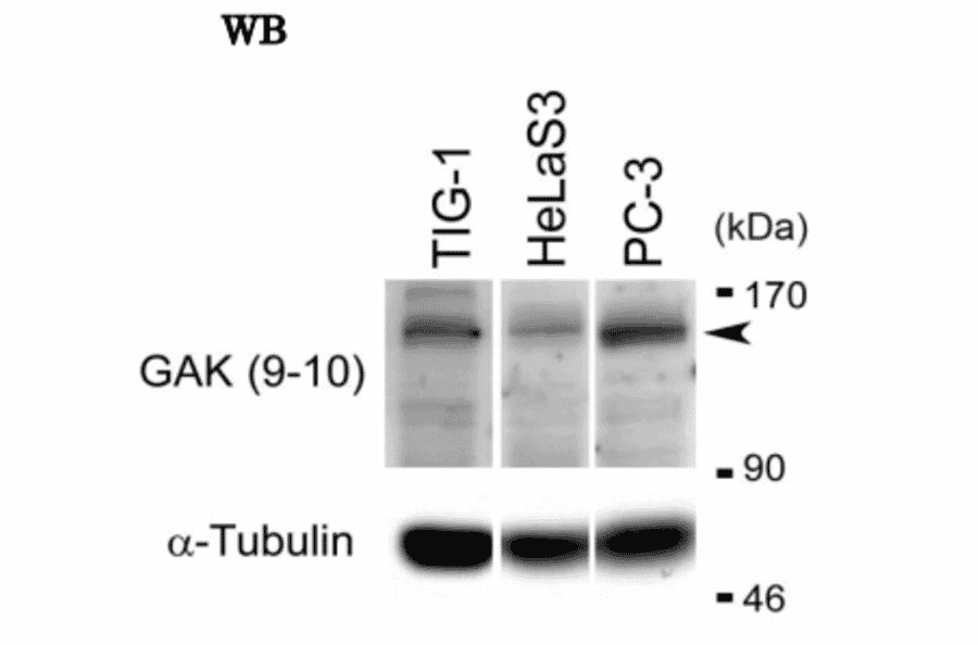 Western blot analysis of endogenous GAK in whole cell extracts of TIG-1, HeLa S3 and PC-3 cells with anti-GAK monoclonal antibody (9-10)