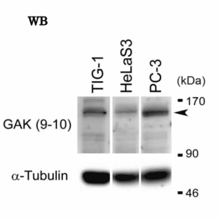 Western blot analysis of endogenous GAK in whole cell extracts of TIG-1, HeLa S3 and PC-3 cells with anti-GAK monoclonal antibody (9-10)