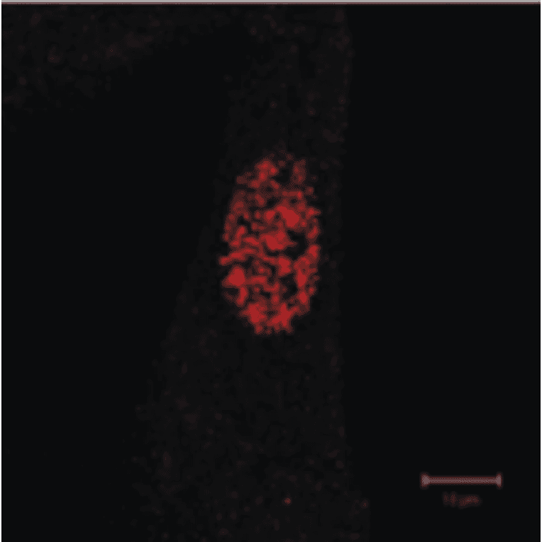 Immunofluorescence staining of GAK in TIG-1 cells with anti-GAK antibody (9-10). The antibody was used at 1/50 dilution. As the second antibody, Texas-Red conjugated sheep anti-mouse IgG was used
