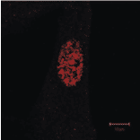 Immunofluorescence staining of GAK in TIG-1 cells with anti-GAK antibody (9-10). The antibody was used at 1/50 dilution. As the second antibody, Texas-Red conjugated sheep anti-mouse IgG was used