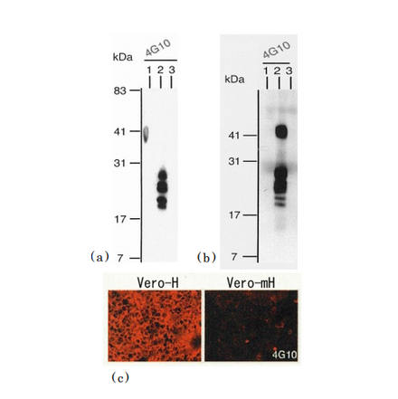 Identification of human HB-EGF by using anti-HB-EGF 4G10