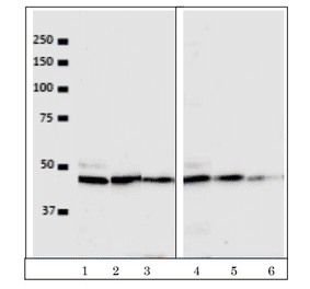 Western blot detection of VRK1 in the crude extracts of human cells. Lanes 1, 2, 3; HeLa cell extract (5x104 cells) with antibody dilutions at 1/100, 1/500, 1/1000. Lanes 4, 5, 6; U2OS cell extract (5x104 cells) with the antibody dilutions at 1/100, 1/500, 1/1,000. As secondary antibody, Alexa488 goat anti-mouse IgG was used. ImmunoStar?R LD (Wako, Tokyo) was used as chemiluminescence reagent and images were taken with BIO-RAD ChemiDocXRS