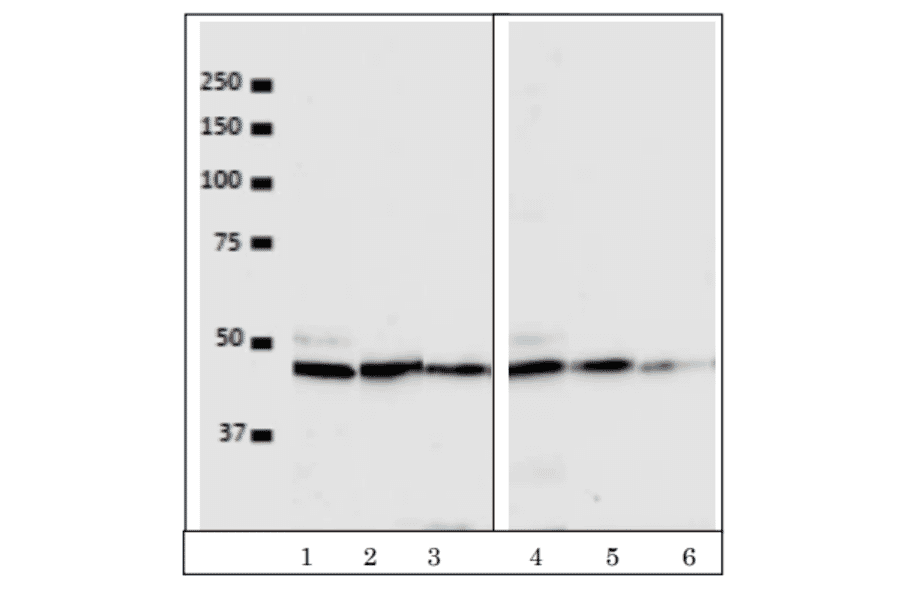 Western blot detection of VRK1 in the crude extracts of human cells. Lanes 1, 2, 3; HeLa cell extract (5x104 cells) with antibody dilutions at 1/100, 1/500, 1/1000. Lanes 4, 5, 6; U2OS cell extract (5x104 cells) with the antibody dilutions at 1/100, 1/500, 1/1,000. As secondary antibody, Alexa488 goat anti-mouse IgG was used. ImmunoStar?R LD (Wako, Tokyo) was used as chemiluminescence reagent and images were taken with BIO-RAD ChemiDocXRS
