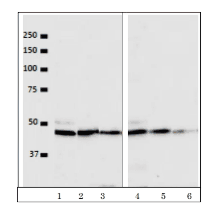 Western blot detection of VRK1 in the crude extracts of human cells. Lanes 1, 2, 3; HeLa cell extract (5x104 cells) with antibody dilutions at 1/100, 1/500, 1/1000. Lanes 4, 5, 6; U2OS cell extract (5x104 cells) with the antibody dilutions at 1/100, 1/500, 1/1,000. As secondary antibody, Alexa488 goat anti-mouse IgG was used. ImmunoStar?R LD (Wako, Tokyo) was used as chemiluminescence reagent and images were taken with BIO-RAD ChemiDocXRS