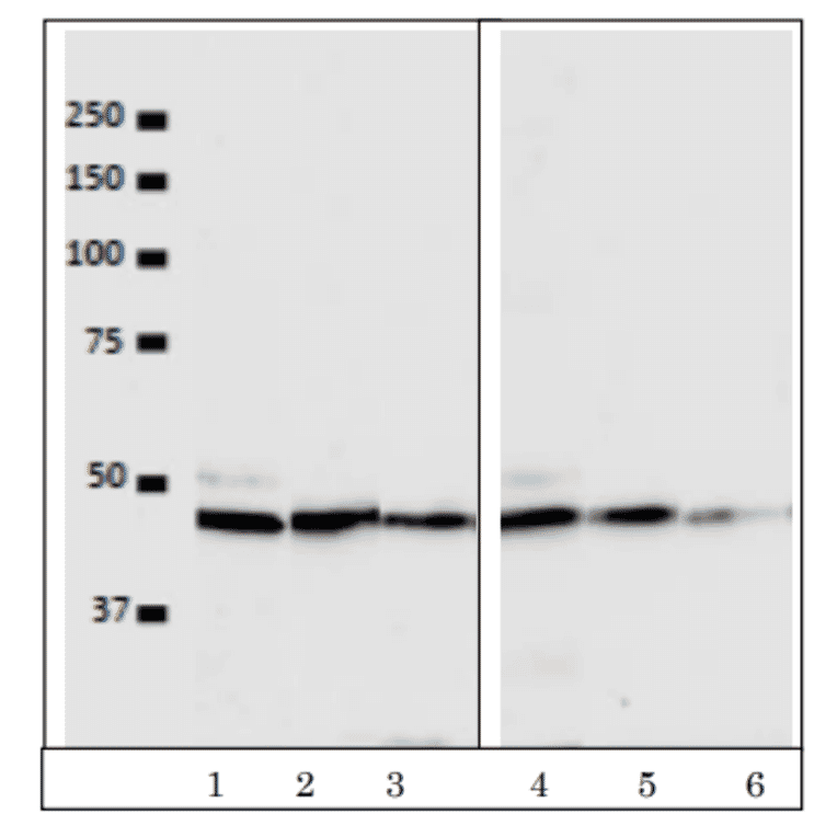 Western blot detection of VRK1 in the crude extracts of human cells. Lanes 1, 2, 3; HeLa cell extract (5x104 cells) with antibody dilutions at 1/100, 1/500, 1/1000. Lanes 4, 5, 6; U2OS cell extract (5x104 cells) with the antibody dilutions at 1/100, 1/500, 1/1,000. As secondary antibody, Alexa488 goat anti-mouse IgG was used. ImmunoStar?R LD (Wako, Tokyo) was used as chemiluminescence reagent and images were taken with BIO-RAD ChemiDocXRS